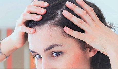 Alopecia Femenina: qué es y cómo tratarla