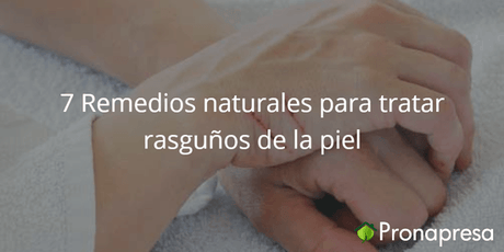 7 Remedios naturales para tratar rasguños de la piel - Tienda Naturista Pronapresa - Bienestar, Consejos, Medicina Tradicional, Naturopatía, Piel, Recetas, Salud
