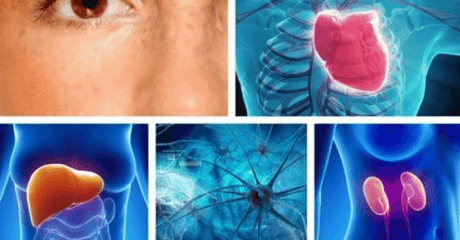 Las 10 partes del cuerpo que se ven afectadas por el estrés 😖 - Tienda Naturista Pronapresa - Cansancio, Consejos, Estrés, Nervios, Salud, Sistema Digestivo