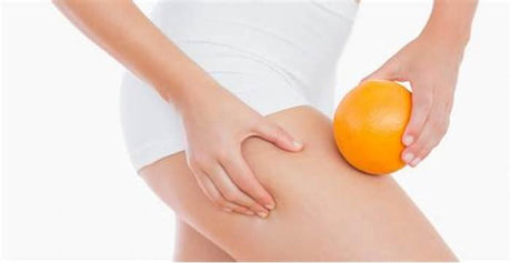 Celulitis: cómo se genera y cómo combatirlas
