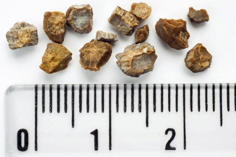¿Hay alimentos que pueden causar piedras en los riñones? 😢 - Tienda Naturista Pronapresa - Colesterol, Depurador, Desintoxicacion, Dieta, Intestino, Nutrición, Salud, Sistema Digestivo