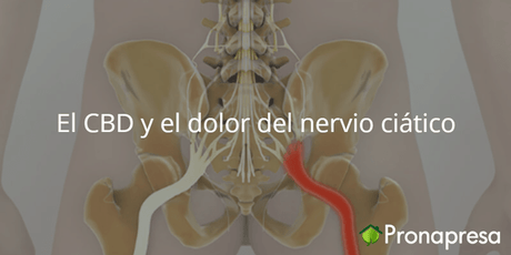 El CBD y el dolor del nervio ciático - Tienda Naturista Pronapresa - Articulaciones, Artritis, Bienestar, Cannabis, CBD, Dolor, Medicina Tradicional, Naturopatía, Nova, Salud