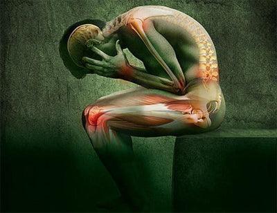 ¿Qué tipos de dolor puede tratar el CBD? 🍁 - Tienda Naturista Pronapresa - Ansiedad, Cannabis, CBD, Consejos, Estrés, Nervios, Salud, Salud Mental