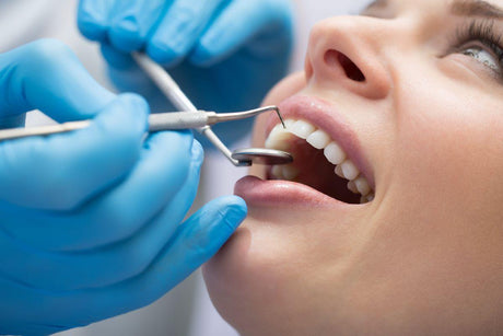 Todo lo que necesitas saber sobre la limpieza dental