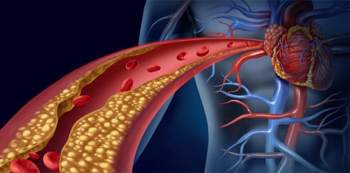 Cómo Mantener El Colesterol A Raya Naturalmente 5011