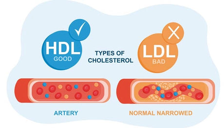 Colesterol LDL, cuando más bajo mejor