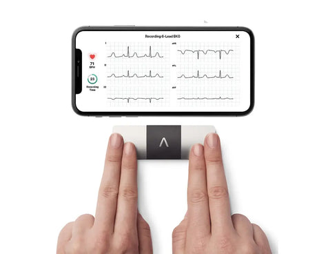 KardiaMobile 6L, Análisis del ritmo cardíaco, Electrocardiograma móvil, enfermedades cardíacas
