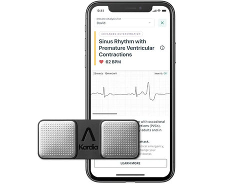 KardiaMobile, Análisis del ritmo cardíaco, Electrocardiograma móvil, enfermedades cardíacas