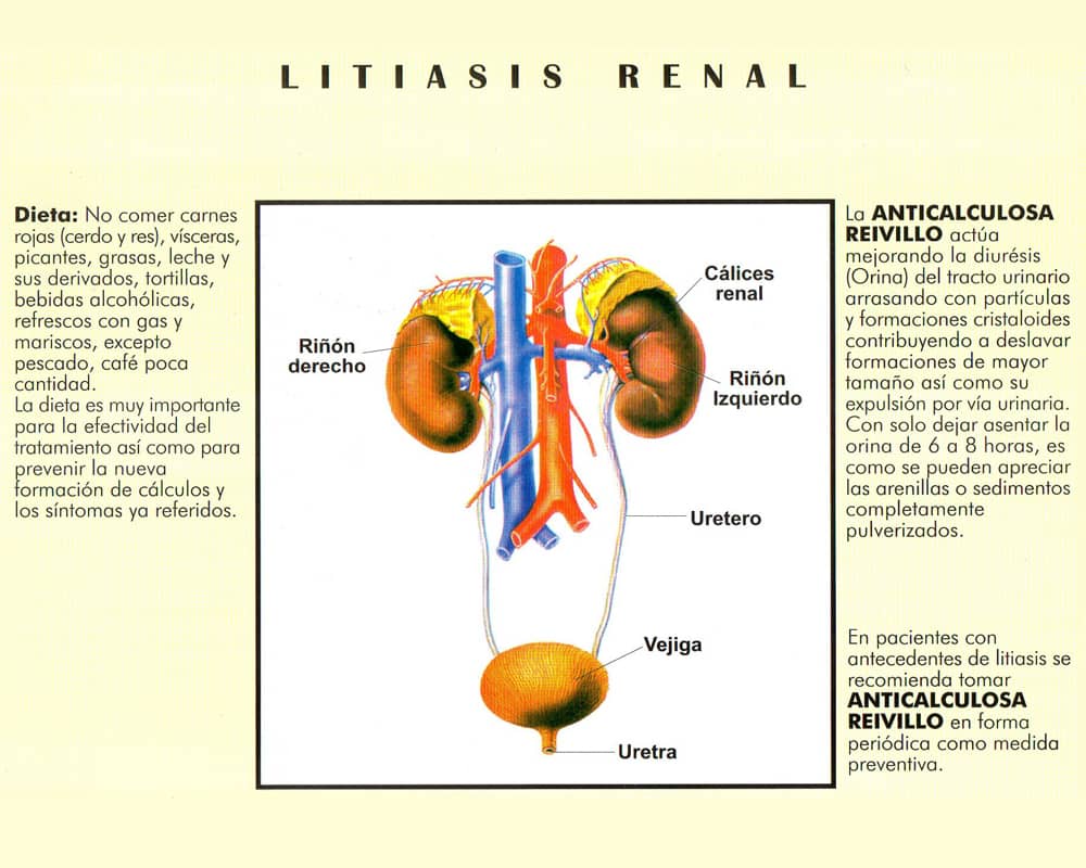 Tratamiento Anticalculosa Reivillo (Tomas)